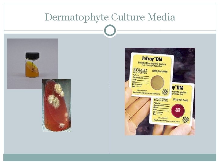 Dermatophyte Culture Media 