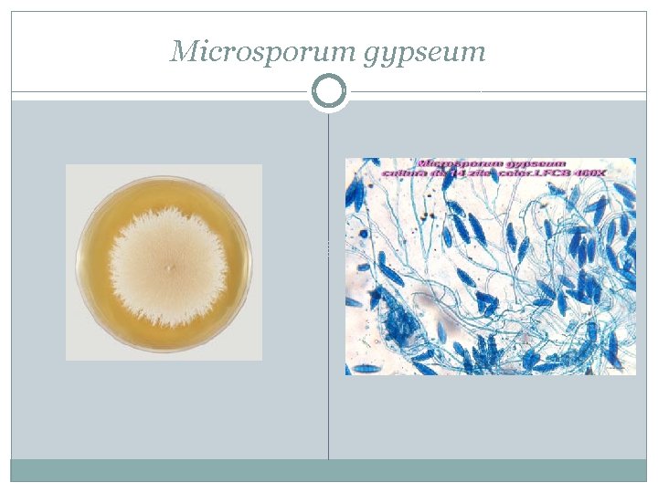 Microsporum gypseum 