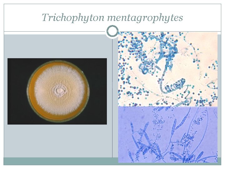 Trichophyton mentagrophytes 