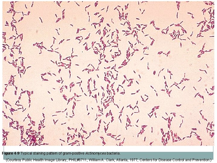 Figure 4 -9 Typical staining pattern of gram-positive Actinomyces bacteria. (Courtesy Public Health Image