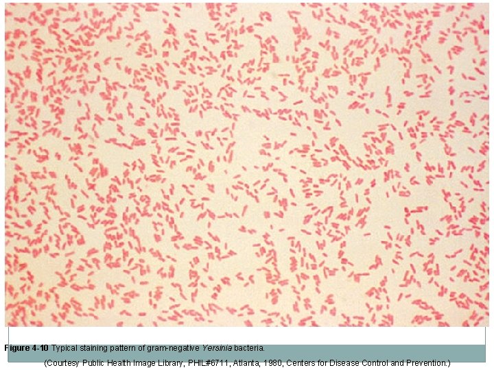 Figure 4 -10 Typical staining pattern of gram-negative Yersinia bacteria. (Courtesy Public Health Image