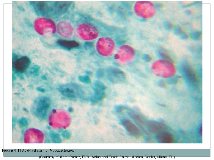 Figure 4 -11 Acid-fast stain of Mycobacterium. (Courtesy of Marc Kramer, DVM, Avian and