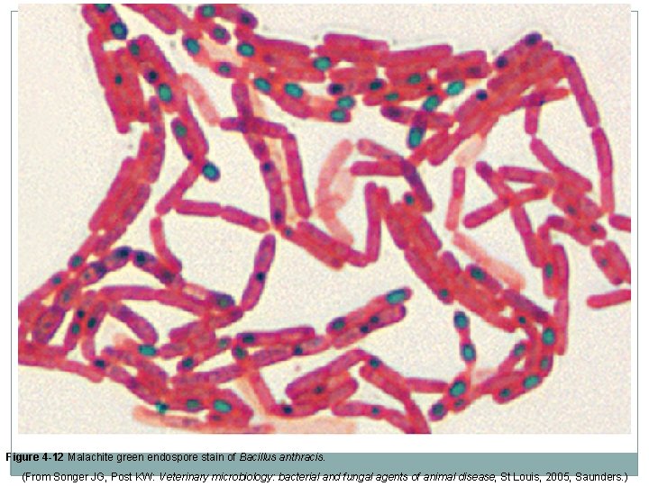 Figure 4 -12 Malachite green endospore stain of Bacillus anthracis. (From Songer JG, Post