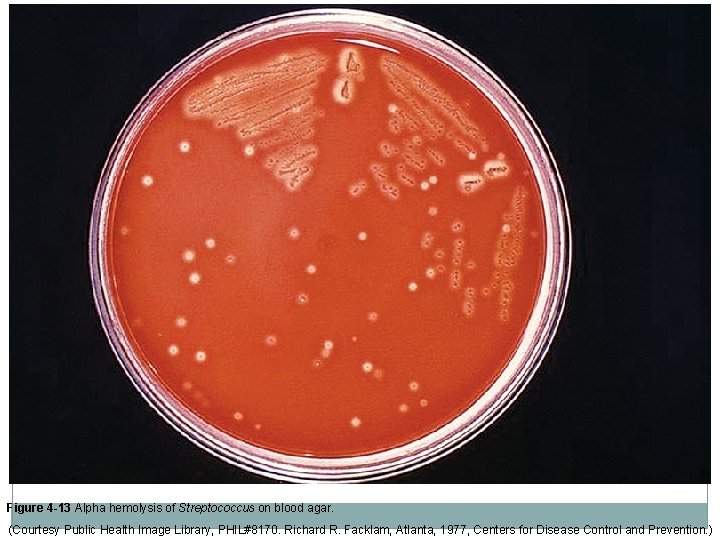 Figure 4 -13 Alpha hemolysis of Streptococcus on blood agar. (Courtesy Public Health Image