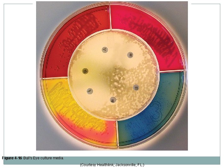 Figure 4 -16 Bull’s Eye culture media. (Courtesy Healthlink, Jacksonville, FL. ) 