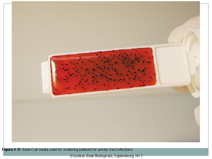 Figure 4 -17 Solar-Cult media used for screening patients for urinary tract infections. (Courtesy