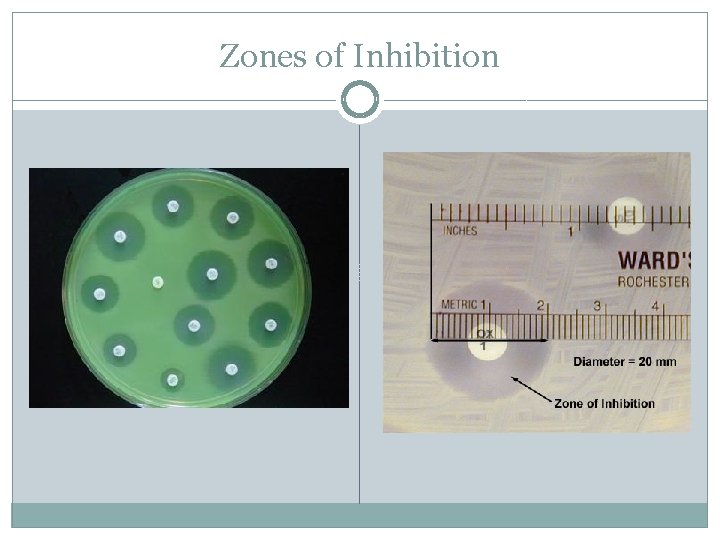 Zones of Inhibition 