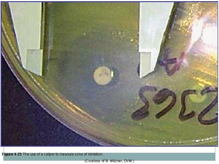 Figure 4 -23 The use of a caliper to measure zone of inhibition. (Courtesy