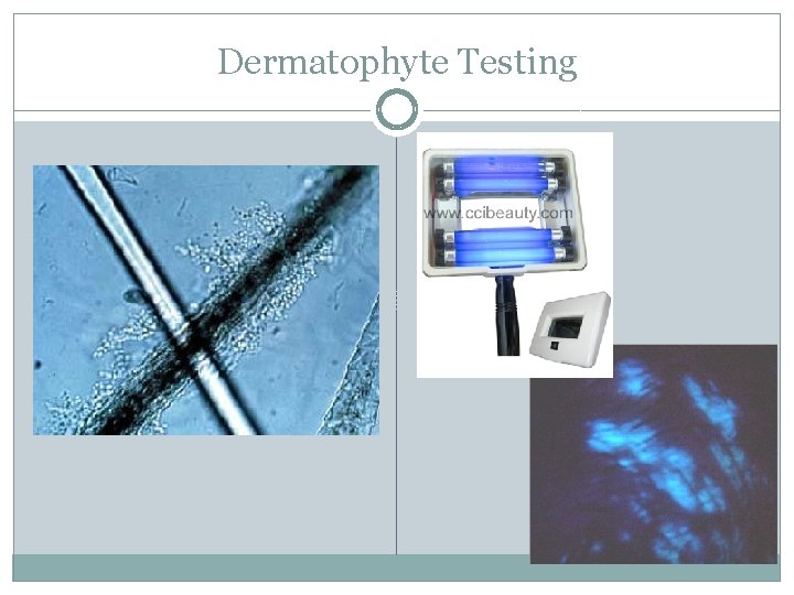 Dermatophyte Testing 