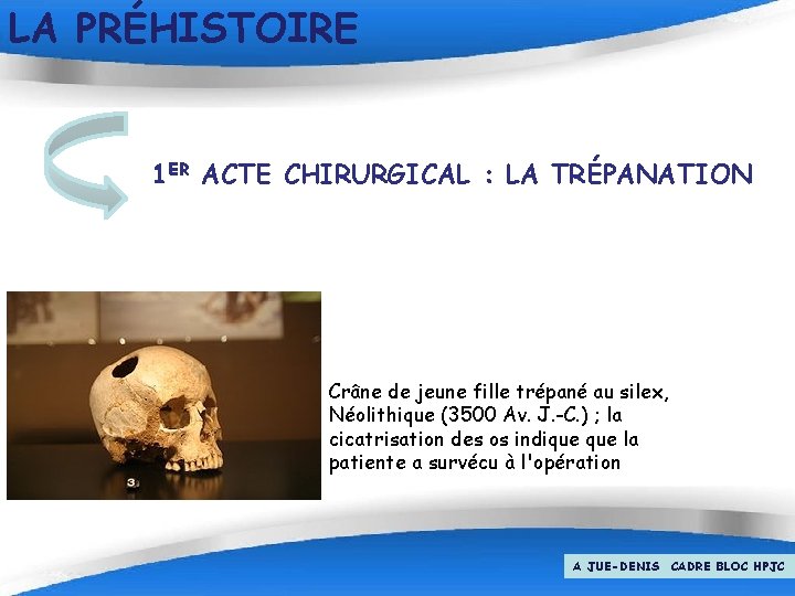 LA PRÉHISTOIRE 1 ER ACTE CHIRURGICAL : LA TRÉPANATION Crâne de jeune fille trépané