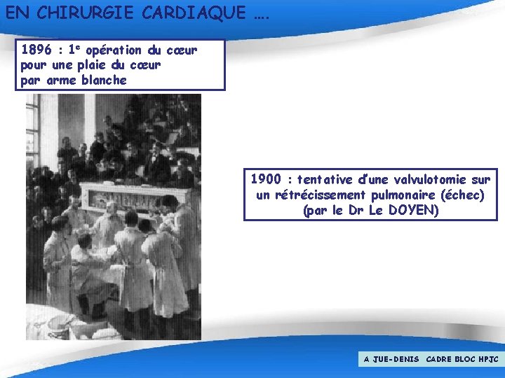 EN CHIRURGIE CARDIAQUE …. 1896 : 1 e opération du cœur pour une plaie