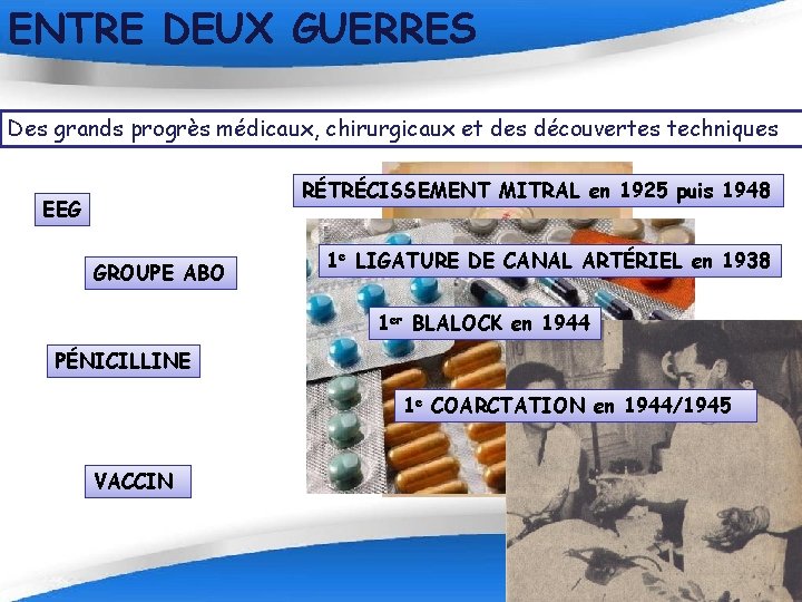 ENTRE DEUX GUERRES Des grands progrès médicaux, chirurgicaux et des découvertes techniques RÉTRÉCISSEMENT MITRAL