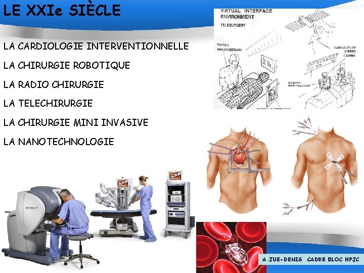 LE XXIe SIÈCLE LA CARDIOLOGIE INTERVENTIONNELLE LA CHIRURGIE ROBOTIQUE LA RADIO CHIRURGIE LA TELECHIRURGIE