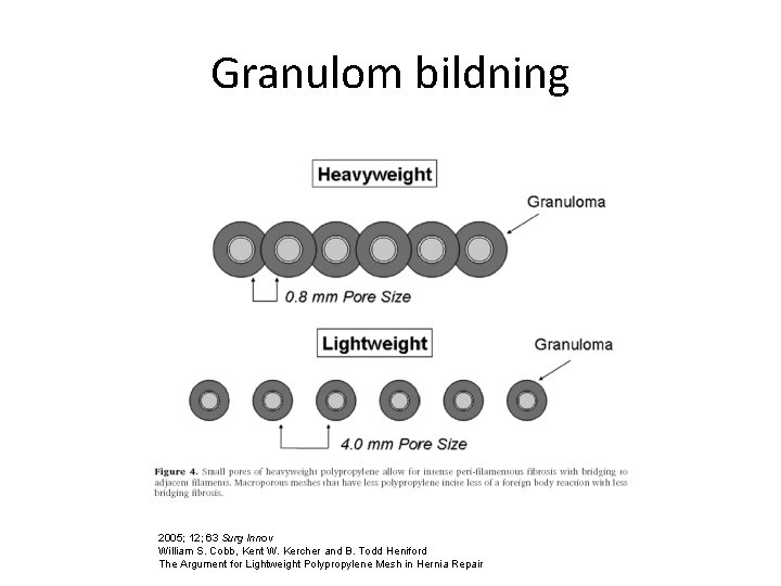 Granulom bildning 2005; 12; 63 Surg Innov William S. Cobb, Kent W. Kercher and