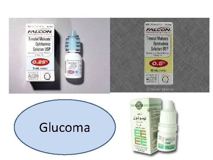 Glucoma 
