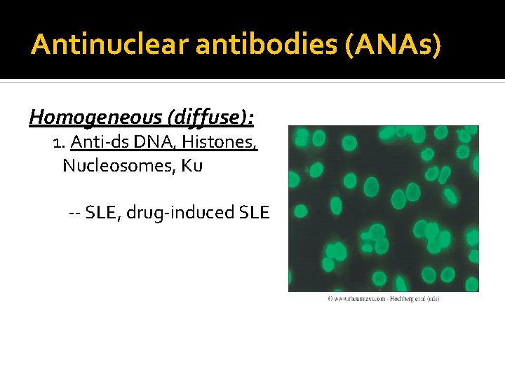 Antinuclear antibodies (ANAs) Homogeneous (diffuse): 1. Anti-ds DNA, Histones, Nucleosomes, Ku -- SLE, drug-induced