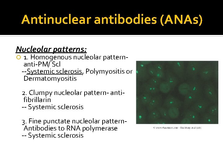 Antinuclear antibodies (ANAs) Nucleolar patterns: 1. Homogenous nucleolar patternanti-PM/ Scl --Systemic sclerosis, Polymyositis or