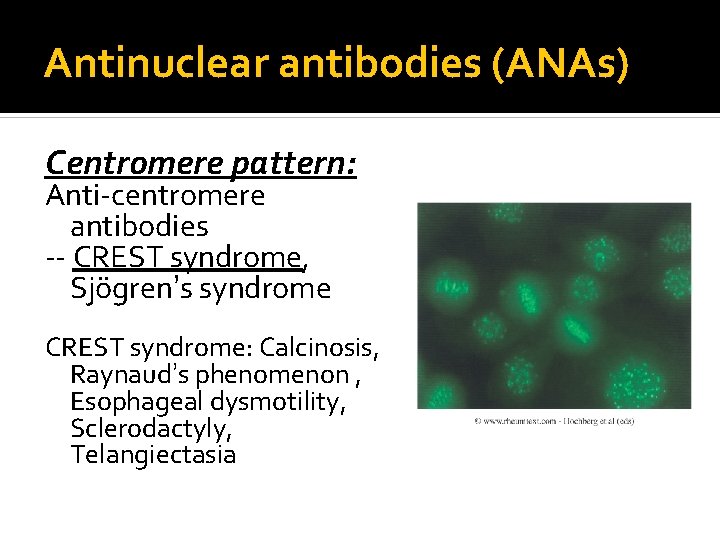 Antinuclear antibodies (ANAs) Centromere pattern: Anti-centromere antibodies -- CREST syndrome, Sjögren’s syndrome CREST syndrome:
