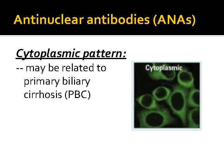 Antinuclear antibodies (ANAs) Cytoplasmic pattern: -- may be related to primary biliary cirrhosis (PBC)
