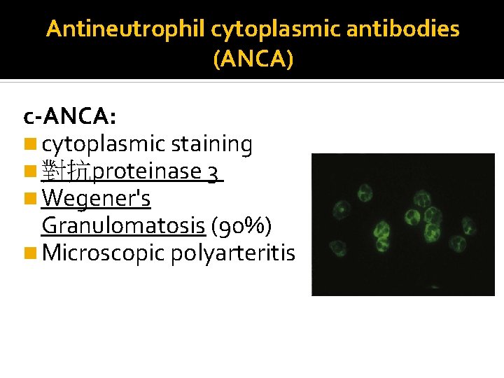 Antineutrophil cytoplasmic antibodies (ANCA) c-ANCA: n cytoplasmic staining n 對抗proteinase 3 n Wegener's Granulomatosis