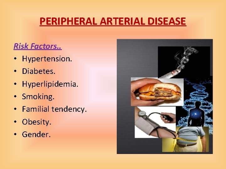 PERIPHERAL ARTERIAL DISEASE Risk Factors. . • Hypertension. • Diabetes. • Hyperlipidemia. • Smoking.
