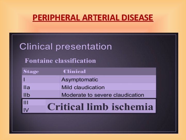 PERIPHERAL ARTERIAL DISEASE 