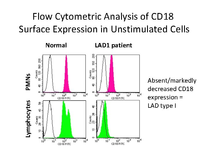 Flow Cytometric Analysis of CD 18 Surface Expression in Unstimulated Cells Lymphocytes PMNs Normal