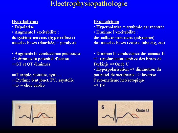 Electrophysiopathologie Hyperkaliémie • Dépolarise • Augmente l’excitabilité : du système nerveux (hyperreflexie) muscles lisses