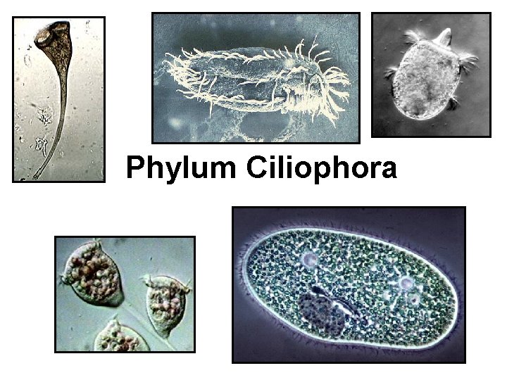 Phylum Ciliophora 