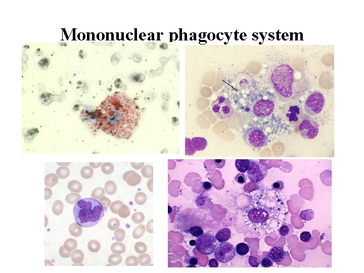 Mononuclear phagocyte system 