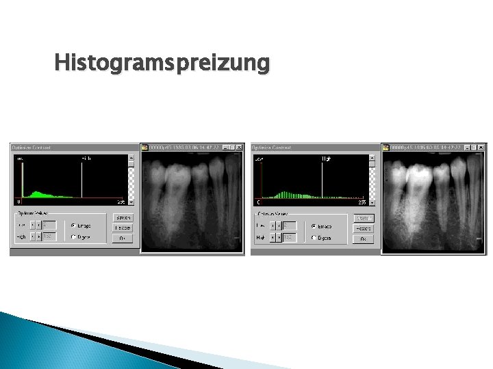 Histogramspreizung 