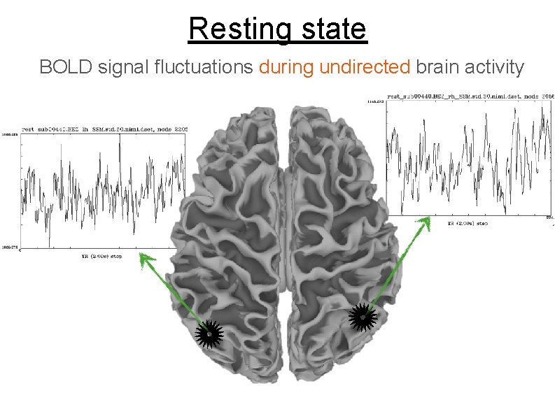 Resting state BOLD signal fluctuations during undirected brain activity 