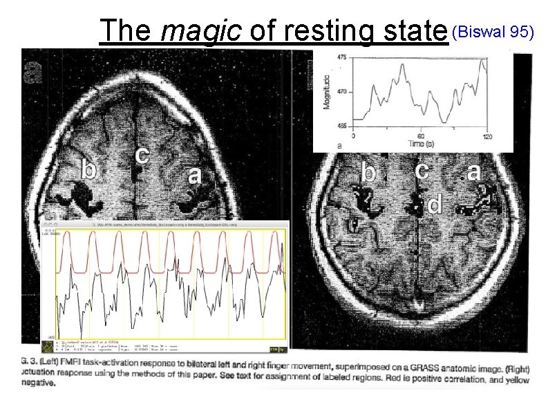 The magic of resting state (Biswal 95) 