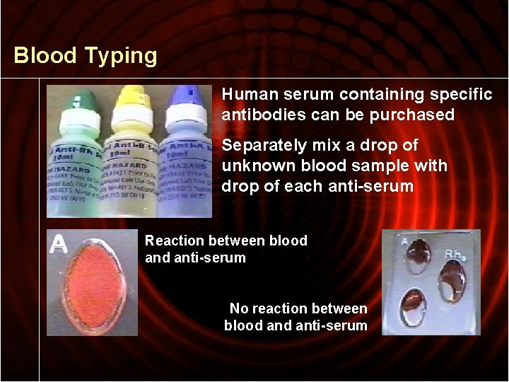Blood Typing Human serum containing specific antibodies can be purchased Separately mix a drop