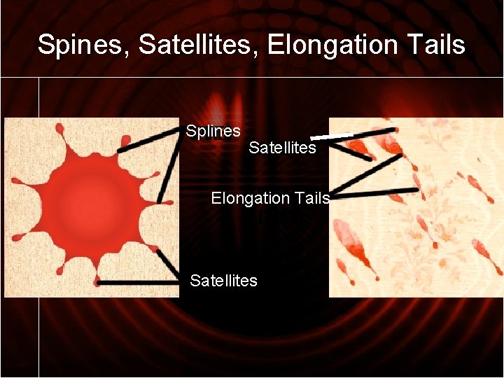 Spines, Satellites, Elongation Tails Splines Satellites Elongation Tails Satellites 