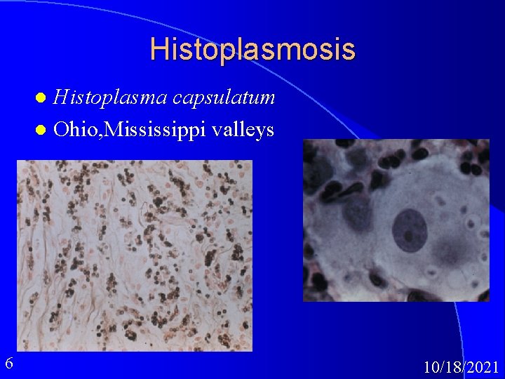 Histoplasmosis Histoplasma capsulatum l Ohio, Mississippi valleys l 6 10/18/2021 