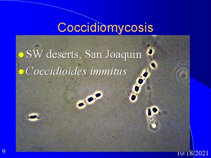 Coccidiomycosis l SW deserts, San Joaquin l Coccidioides immitus 9 10/18/2021 