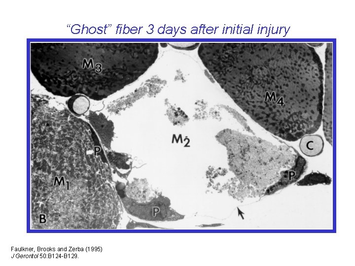 “Ghost” fiber 3 days after initial injury Faulkner, Brooks and Zerba (1995) J Gerontol