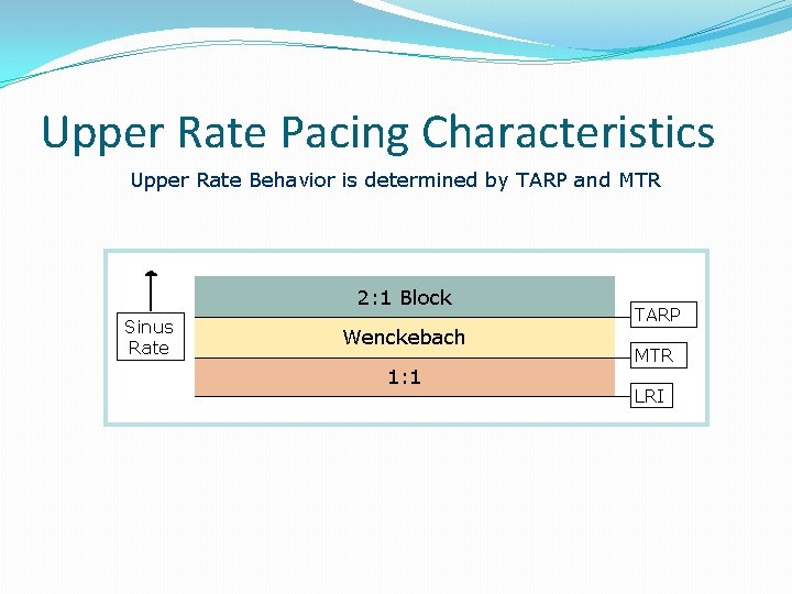 Upper Rate Pacing Characteristics Upper Rate Behavior is determined by TARP and MTR 2: