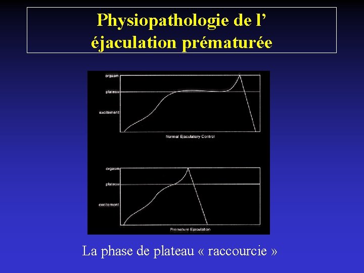 Physiopathologie de l’ éjaculation prématurée La phase de plateau « raccourcie » 