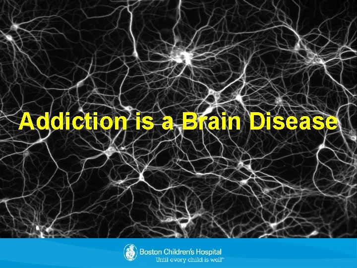 Addiction is a Brain Disease 