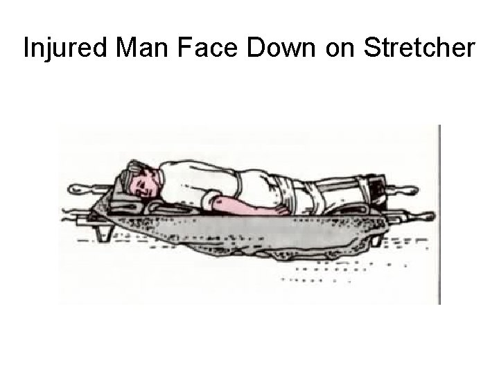 Injured Man Face Down on Stretcher 
