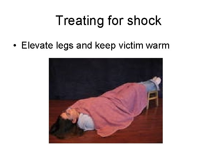 Treating for shock • Elevate legs and keep victim warm 