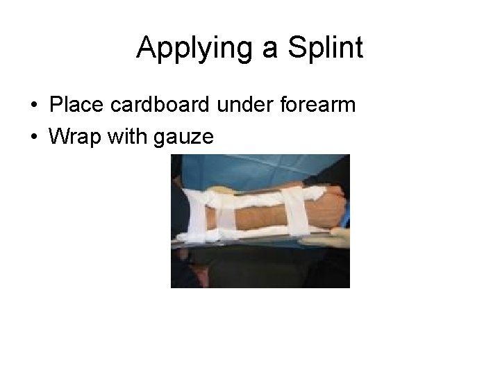 Applying a Splint • Place cardboard under forearm • Wrap with gauze 