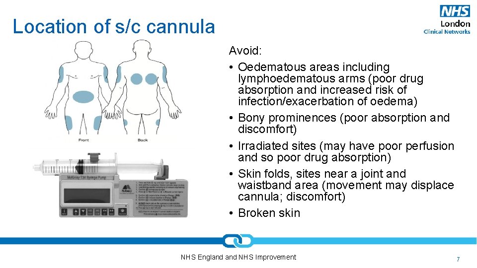 Location of s/c cannula Avoid: • Oedematous areas including lymphoedematous arms (poor drug absorption