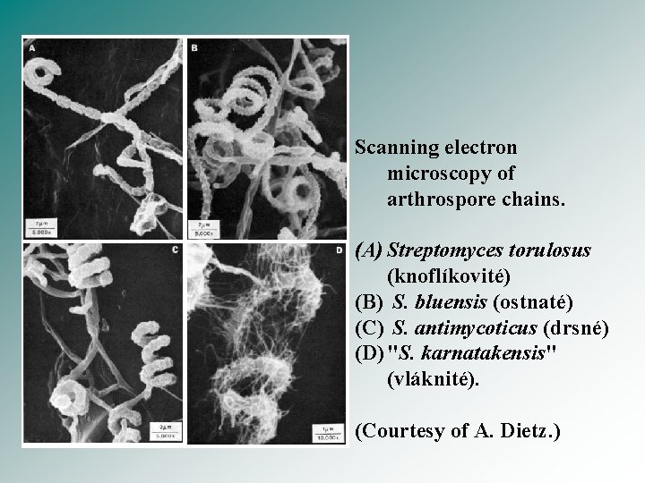 Scanning electron microscopy of arthrospore chains. (A) Streptomyces torulosus (knoflíkovité) (B) S. bluensis (ostnaté)