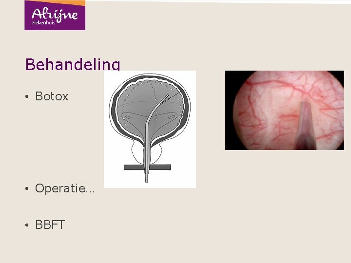 Behandeling • Botox • Operatie… • BBFT 