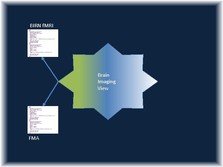 BIRN f. MRI Brain Imaging View FMA 