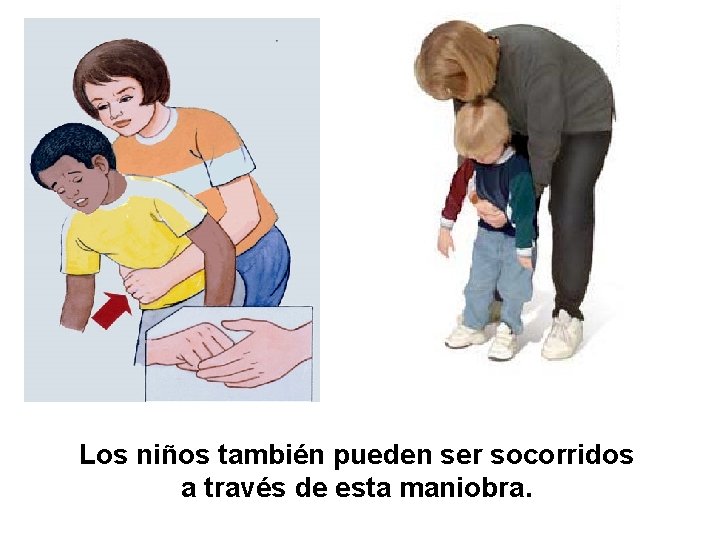 Los niños también pueden ser socorridos a través de esta maniobra. 