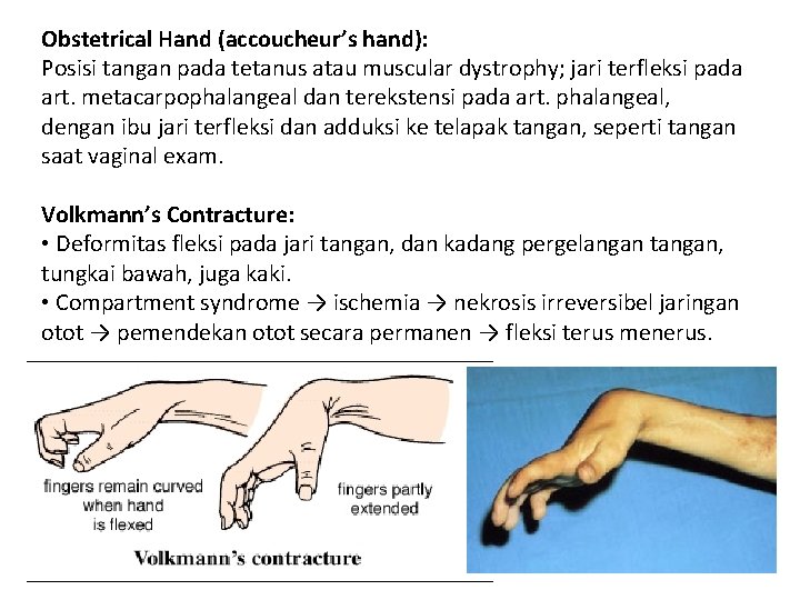 Obstetrical Hand (accoucheur’s hand): Posisi tangan pada tetanus atau muscular dystrophy; jari terfleksi pada